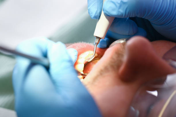 Best Mobile Emergency Dentist in Tropical Park, FL