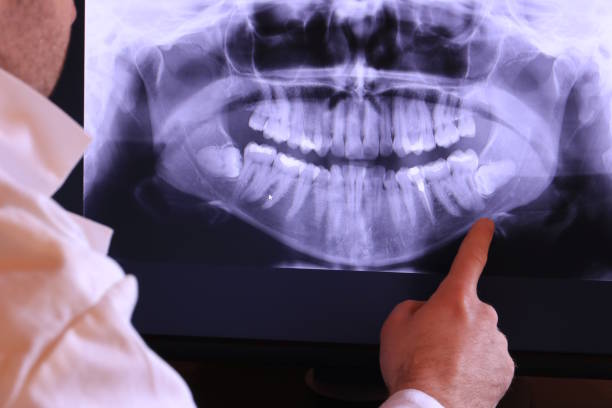 Best Emergency Dentist for Knocked-Out Tooth in Tropical Park, FL