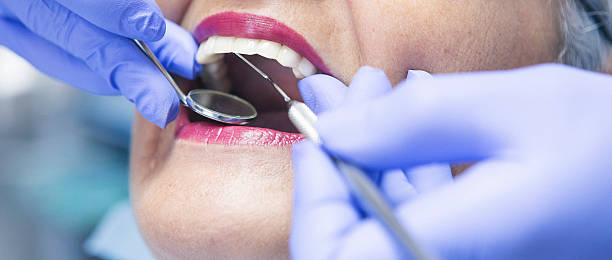 Best Emergency Dentist for Lost Fillings or Crowns in Tropical Park, FL